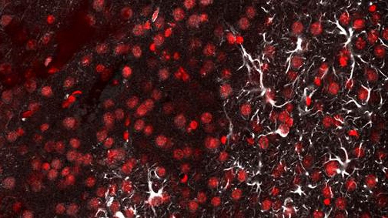 Neuronas (rojo) y astrocitos (blanco) activados en la corteza cerebral cercana a un traumatismo craneoencef�lico.