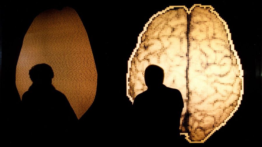 Descubren una zona del cerebro de pacientes con esquizofrenia que «oyen voces» G14M6454