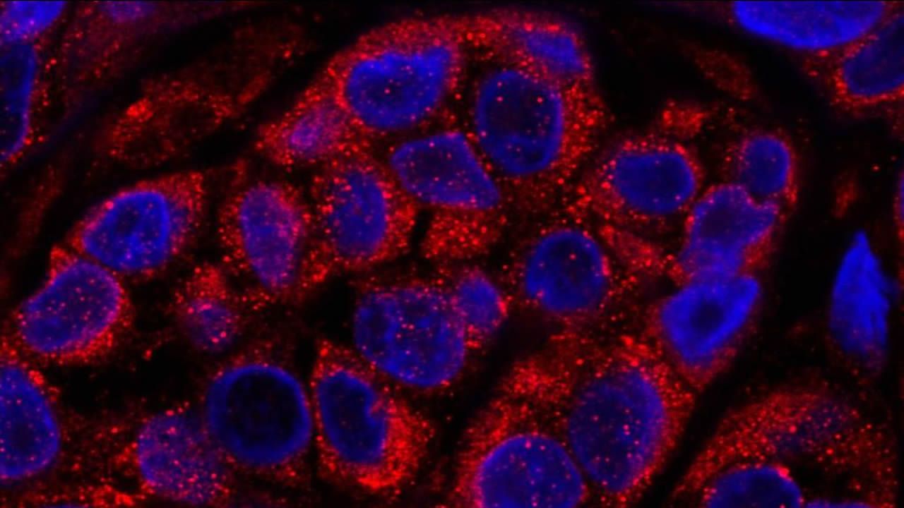 Este es el sorprendente descubrimiento�realizado en los Picos de Europa.El investigador asturiano Pablo Men�ndez, en el centro de la imagen, sin bata