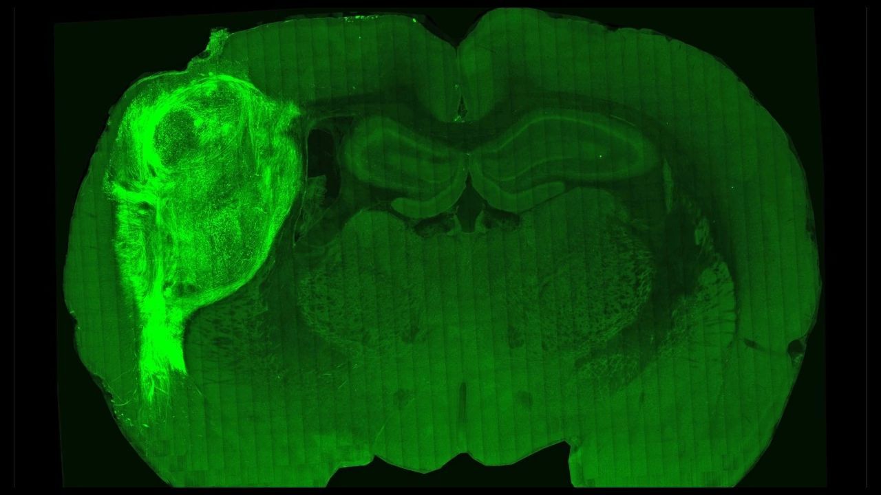 Implante de organoide de cerebro humano en una rata
