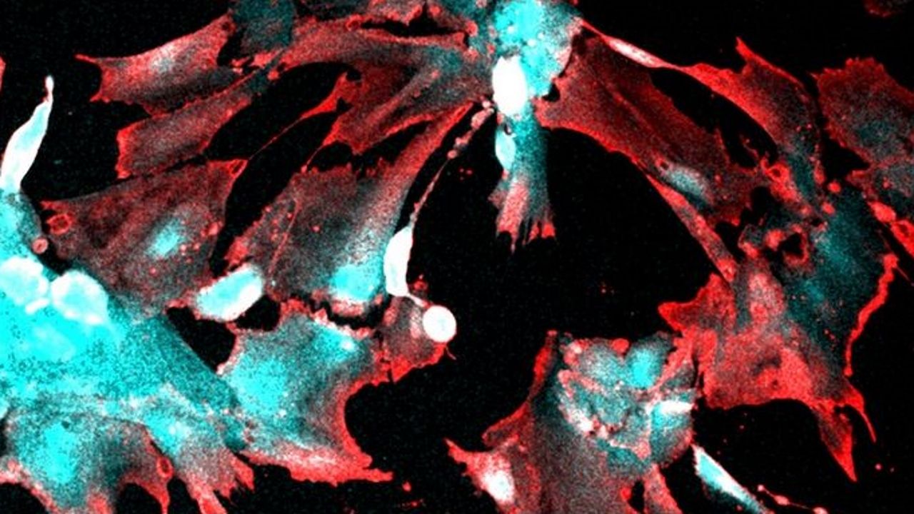 Una imagen para la historia: la ciencia muestra el agujero negro Sagitario A*.C�lulas infectadas con el SARS-CoV-2