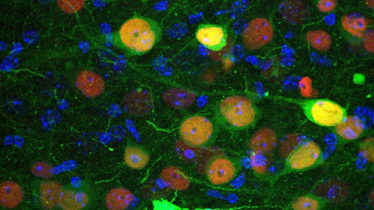 Imagen de microscop�a confocal que muestra c�lulas de la am�gdala basolateral